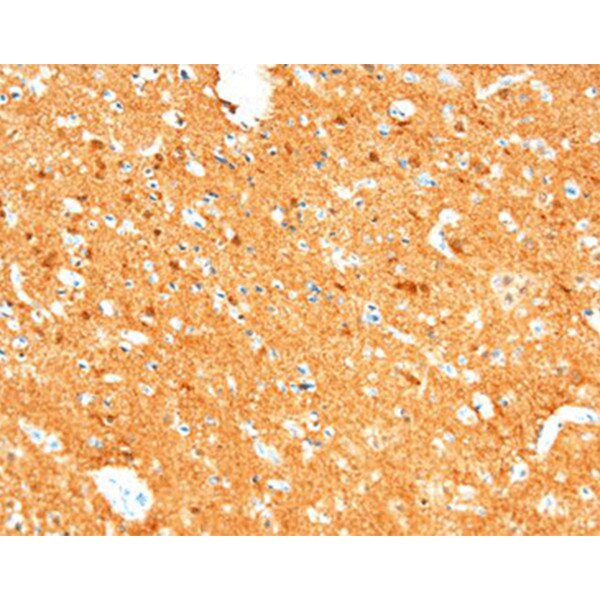 Neuron-Specific Enolase